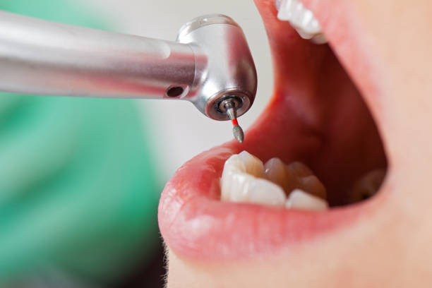 Best Weekend Emergency Dentist in Butler, NJ